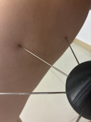 Kinkista™ Spiked Spreader for Women photo review